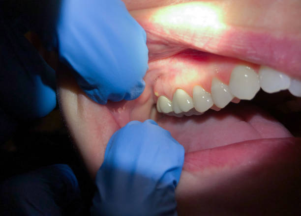 Best Emergency Dentist for Special Needs Patients in Mathews, LA